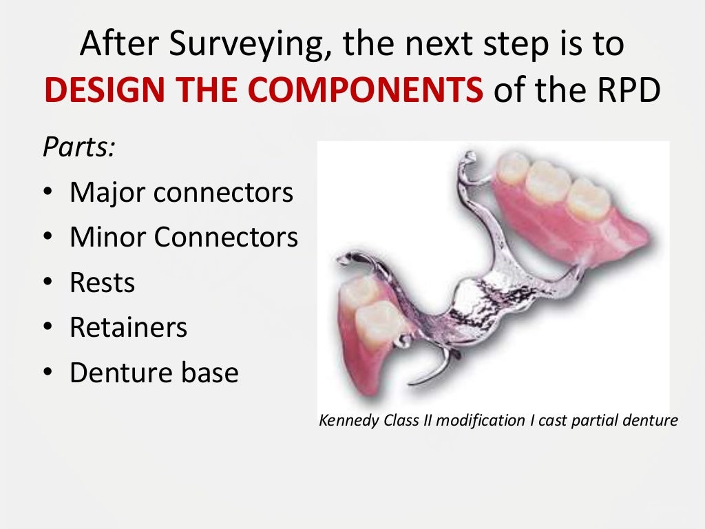 Designing a Removable Partial Denture (Kennedy's Classification)