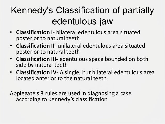 designing a removable partial denture kennedy s kennedy classification
