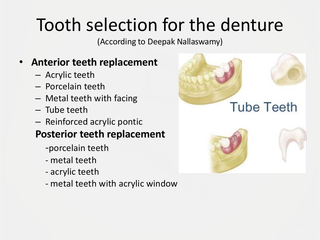Designing a Removable Partial Denture (Kennedy's Classification)