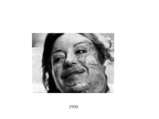 1990 