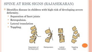 Toppling Sign TB SPINE with potts parapelgia in young adolescents.pptx