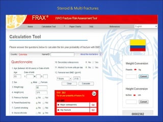 Steroid & Multi fractures
 
