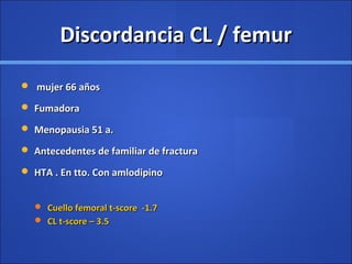 Discordancia CL / femurDiscordancia CL / femur
 mujer 66 añosmujer 66 años
 FumadoraFumadora
 Menopausia 51 a.Menopausia 51 a.
 Antecedentes de familiar de fracturaAntecedentes de familiar de fractura
 HTA . En tto. Con amlodipinoHTA . En tto. Con amlodipino
 Cuello femoral t-score -1.7Cuello femoral t-score -1.7
 CL t-score – 3.5CL t-score – 3.5
 