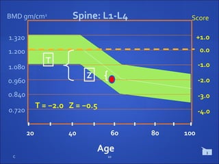 C 10
Score
T = −2.0 Z = −0.5
0.0
-1.0
-2.0
-3.0
+1.0
T
Z
20 40 60 80 100
1.200
0.960
0.840
-4.00.720
1.080
1.320
BMD gm/cm2
Spine: L1-L4
Age 3
 