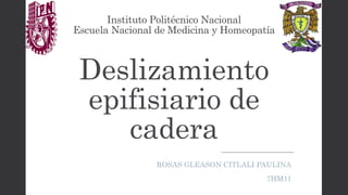 Instituto Politécnico Nacional
Escuela Nacional de Medicina y Homeopatía
Deslizamiento
epifisiario de
cadera
ROSAS GLEASON CITLALI PAULINA
7HM11
 