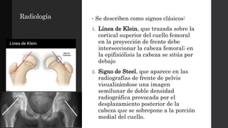 Radiología • Se describen como signos clásicos:
1. Línea de Klein, que trazada sobre la
cortical superior del cuello femoral
en la proyección de frente debe
interseccionar la cabeza femoral; en
la epifisiólisis la cabeza se sitúa por
debajo
2. Signo de Steel, que aparece en las
radiografías de frente de pelvis
visualizándose una imagen
semilunar de doble densidad
radiográfica provocada por el
desplazamiento posterior de la
cabeza que se sobrepone a la porción
medial del cuello.
 