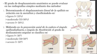 • El grado de desplazamiento anatómico se puede evaluar
en las radiografías simples mediante dos métodos:
1. Determinando el desplazamiento lineal de la epífisis en
relación con la metáfisis y clasificándolo en:
ligero (< 33%)
moderado (33-50%)
severo (> 50%).
2. Midiendo en la proyección axial de la cadera el ángulo
epifisodiafisario, o ángulo de Southwick; el grado de
deslizamiento angular se clasifica en:
ligero (< 30°)
moderado (30-50°)
severo (> 50°)
 