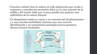 • Conviene valorar bien la cadera en todo adolescente que acuda a
urgencias o consulta por presentar dolor en la cara anterior de la
rodilla o del muslo, dado que es muy posible que padezca una
epifisiólisis de la cabeza femoral
• Un diagnóstico tardío se asocia a un aumento del desplazamiento
y a una elevada morbilidad, mientras que una correcta
identificación y un tratamiento quirúrgico precoz permiten
obtener buenos resultados.
 