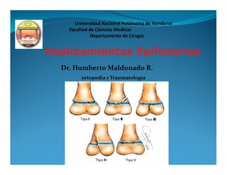 Deslizamientos Epifisiarios
  Dr. Humberto Maldonado R.
       ortopedia y Traumatología
 