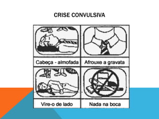 CRISE CONVULSIVA