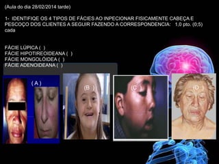 (Aula do dia 28/02/2014 tarde)
1- IDENTIFIQE OS 4 TIPOS DE FÁCIES AO INPECIONAR FISICAMENTE CABEÇA E
PESCOÇO DOS CLIENTES A SEGUIR FAZENDO A CORRESPONDENCIA: 1,0 pto. (0;5)
cada
FÁCIE LÚPICA ( )
FÁCIE HIPOTIREOIDEANA ( )
FÁCIE MONGOLÓIDEA ( )
FÁCIE ADENOIDEANA ( )
( A )
(B ) (C ) (D )
 
