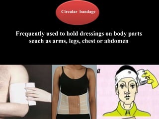Circular bandage
Frequently used to hold dressings on body parts
seuch as arms, legs, chest or abdomen
 