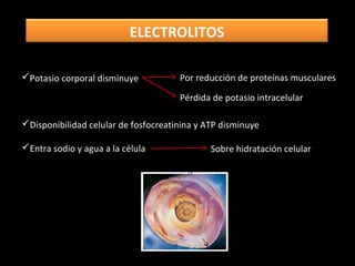Potasio corporal disminuye Por reducción de proteínas musculares
Pérdida de potasio intracelular
Disponibilidad celular de fosfocreatinina y ATP disminuye
Entra sodio y agua a la célula Sobre hidratación celular
ELECTROLITOS
 