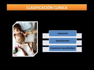 CLASIFICACIÓN CLÍNICA
 