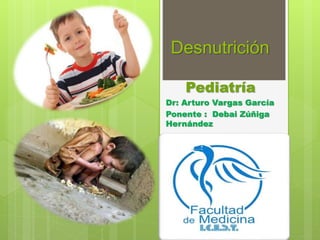 Desnutrición 
Pediatría 
Dr: Arturo Vargas García 
Ponente : Debai Zúñiga 
Hernández 
 