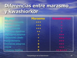 Diferencias entre marasmo y kwashiorkor Kwashiorkor + + + + +++ +++ +++ +++ +++ ++ a +++ Marasmo  +++ +++ +++ ++ + + + 0 0 0 Signos Retardo crecimiento Pérdida de peso Atrofia muscular Trastornos digestivos Alteraciones psíquicas Alteraciones cabello Hipoproteinemia Dermatosis pelagrosa Edema Esteatosis hepática 