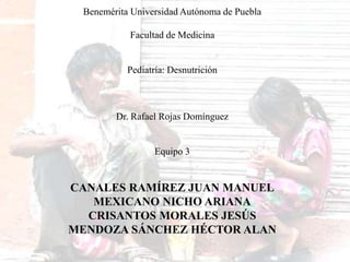 Benemérita Universidad Autónoma de Puebla
Facultad de Medicina
Pediatría: Desnutrición
Dr. Rafael Rojas Domínguez
Equipo 3
CANALES RAMÍREZ JUAN MANUEL
MEXICANO NICHO ARIANA
CRISANTOS MORALES JESÚS
MENDOZA SÁNCHEZ HÉCTOR ALAN
 