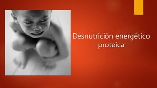 Desnutrición energético
proteica
 