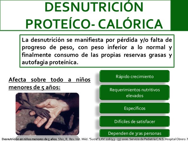 Desnutrición en menores de 5 años