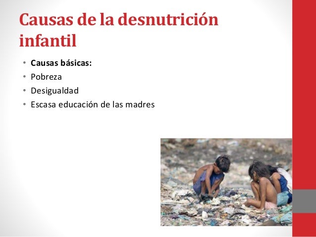 Desnutrición infantil Desnutrición infantil