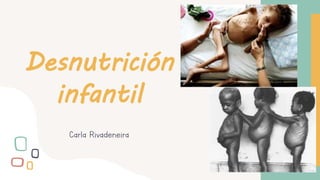 Desnutrición
infantil
Carla Rivadeneira
 