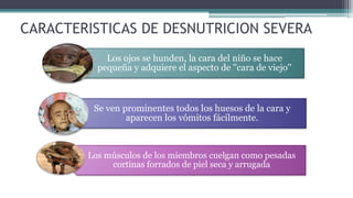 CARACTERISTICAS DE DESNUTRICION SEVERA
Los ojos se hunden, la cara del niño se hace
pequeña y adquiere el aspecto de ''cara de viejo''
Se ven prominentes todos los huesos de la cara y
aparecen los vómitos fácilmente.
Los músculos de los miembros cuelgan como pesadas
cortinas forrados de piel seca y arrugada
 