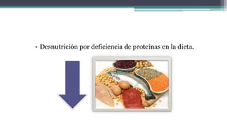 • Desnutrición por deficiencia de proteínas en la dieta.
 