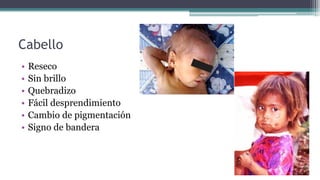 Cabello
• Reseco
• Sin brillo
• Quebradizo
• Fácil desprendimiento
• Cambio de pigmentación
• Signo de bandera
 