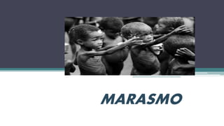 MARASMO
 