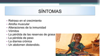 SÍNTOMAS
• Retraso en el crecimiento
• Atrofia muscular
• Alteraciones de la inmunidad
• Vómitos
• La pérdida de las reservas de grasa
• La pérdida de peso
• La diarrea crónica
• Un abdomen distendido.
 