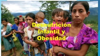 Desnutrición
Infantil y
Obesidad
 