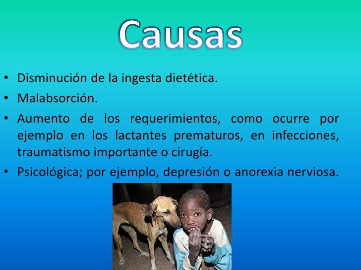 Desnutricion