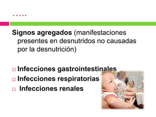 …..
Signos agregados (manifestaciones
presentes en desnutridos no causadas
por la desnutrición)

Infecciones gastrointestinales
 Infecciones respiratorias
 Infecciones renales


 