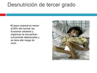 Desnutrición de tercer grado

•El peso corporal es menor
al 60% del normal; las
funciones celulares y
orgánicas se encuentran
sumamente deterioradas y
se tiene alto riesgo de
morir.

 