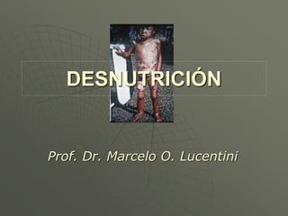 DESNUTRICIÓN
Prof. Dr. Marcelo O. Lucentini
 