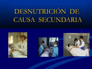 DESNUTRICIÓN DEDESNUTRICIÓN DE
CAUSA SECUNDARIACAUSA SECUNDARIA
 