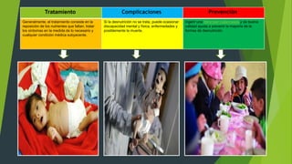 Tratamiento Complicaciones Prevención
Generalmente, el tratamiento consiste en la
reposición de los nutrientes que faltan, tratar
los síntomas en la medida de lo necesario y
cualquier condición médica subyacente.
Si la desnutrición no se trata, puede ocasionar
discapacidad mental y física, enfermedades y
posiblemente la muerte.
Ingerir una dieta bien balanceada y de buena
calidad ayuda a prevenir la mayoría de la
formas de desnutrición.
 