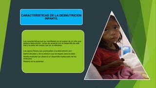 CARACTERISTICAS DE LA DESNUTRICION
INFANTIL
Las características que se manifiestan en el cuerpo de un niño que
padece desnutrición, varían de acuerdo con el desarrollo de este
mal y la parte del cuerpo que se ve afectado.
Los signos físicos que acompañan a la desnutrición son:
Déficit del peso y de la estatura que se espera para la edad.
Atrofia muscular (se observa un desarrollo inadecuado de los
músculos.
Retardo en la pubertad.
 
