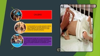 CAUSAS
La desnutrición se puede presentar debido
a la carencia de una sola vitamina en la
dieta o debido a que la persona no está
recibiendo suficiente alimento.
La desnutrición puede ser lo suficientemente leve
como para no presentar síntomas o tan grave
que el daño ocasionado sea irreversible, a pesar
de que se pueda mantener a la persona con
vida.
 