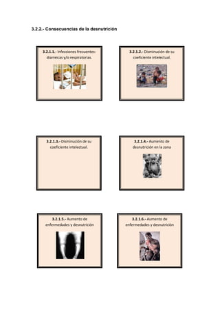 Desnutricion    Ivonne  Cuzcano