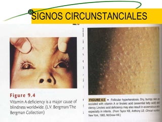 SIGNOS CIRCUNSTANCIALES 