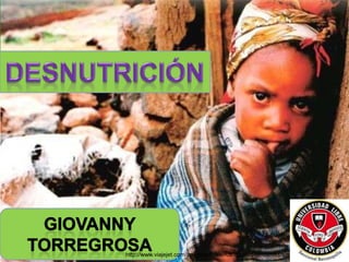 http://www.viajejet.com/imagenes-desnutricion-en-africa/desnutricion-en-africa/
 