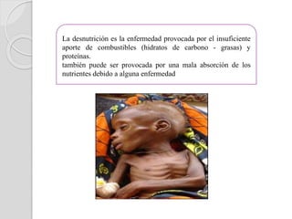 La desnutrición es la enfermedad provocada por el insuficiente
aporte de combustibles (hidratos de carbono - grasas) y
proteínas.
también puede ser provocada por una mala absorción de los
nutrientes debido a alguna enfermedad
 