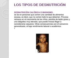 DESNUTRICIÓN CALÓRICA O MARASMO.
se da en personas que comen una cantidad de alimentos
escasa, es decir, que no comen todo lo que deberían. Provoca
retrasos en el crecimiento de los niños, pérdida de tejido graso y
una delgadez muy elevada, que puede incluso llegar a
considerarse caquexia. Otras consecuencias son el cansancio
generalizado, el bajo rendimiento laboral o académico.
•
 