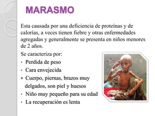 Esta causada por una deficiencia de proteínas y de
calorías, a veces tienen fiebre y otras enfermedades
agregadas y generalmente se presenta en niños menores
de 2 años.
Se caracteriza por:
• Perdida de peso
• Cara envejecida
 Cuerpo, piernas, brazos muy
delgados, son piel y huesos
• Niño muy pequeño para su edad
• La recuperación es lenta
 