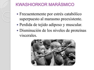  Frecuentemente por estrés catabólico
superpuesto al marasmo preexistente.
 Perdida de tejido adiposo y muscular.
 Disminución de los niveles de proteínas
viscerales.
 