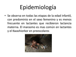 Epidemiología
• Se observa en todas las etapas de la edad infantil,
con predominio en el sexo femenino y es menos
frecuente en lactantes que recibieron lactancia
materna. El marasmo es mas común en lactantes
y el Kwashiorkor en preescolares
 
