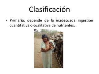 Clasificación
• Primaria: depende de la inadecuada ingestión
cuantitativa o cualitativa de nutrientes.
 