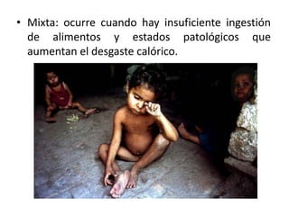 • Mixta: ocurre cuando hay insuficiente ingestión
de alimentos y estados patológicos que
aumentan el desgaste calórico.
 