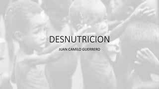 DESNUTRICION
JUAN CAMILO GUERRERO
 
